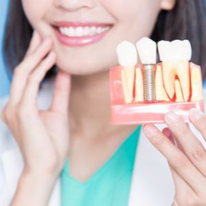Cedarvale Dental Implants 